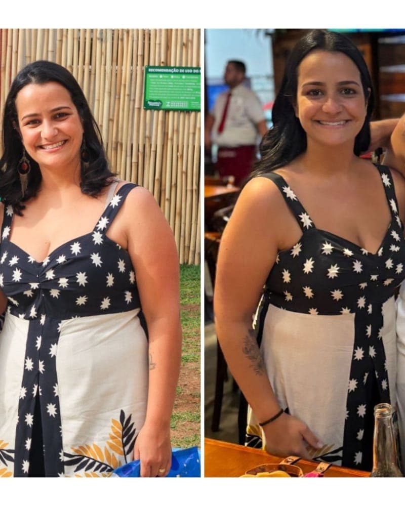Transformação de Janaína, 49 anos, paciente da Alyne Viana