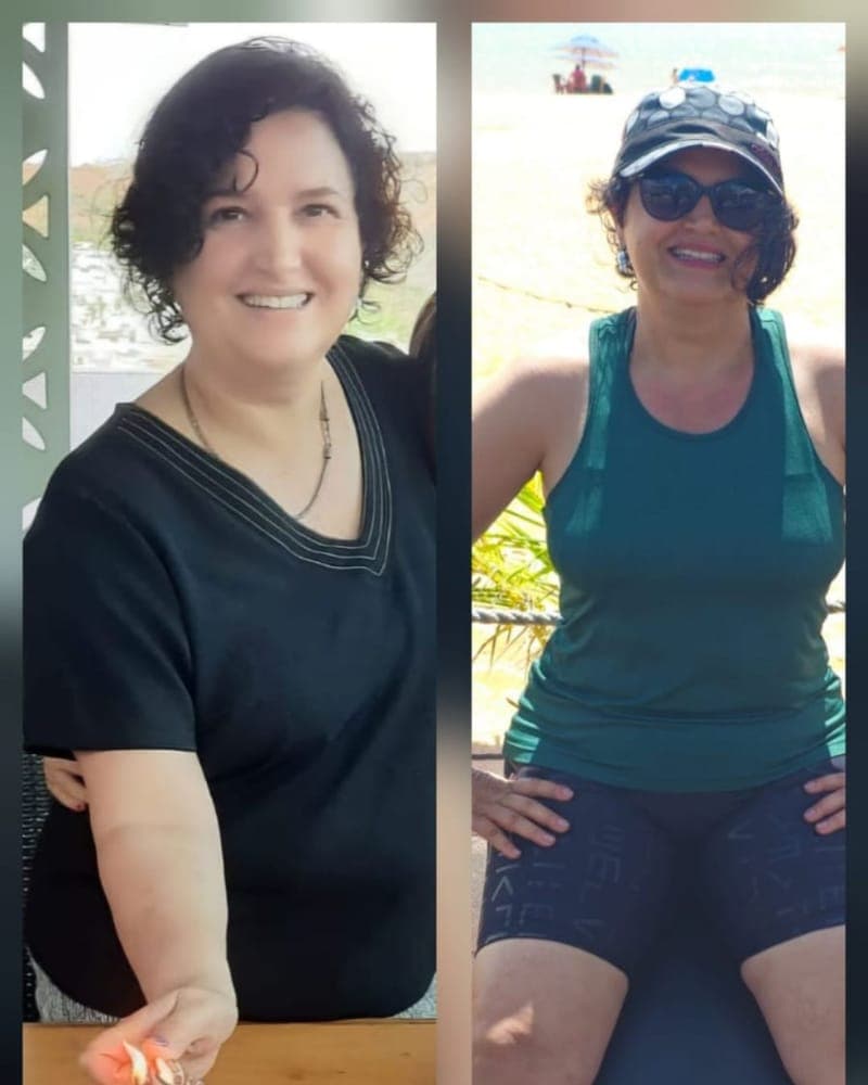 Transformação de Maria, 53 anos, paciente da Alyne Viana