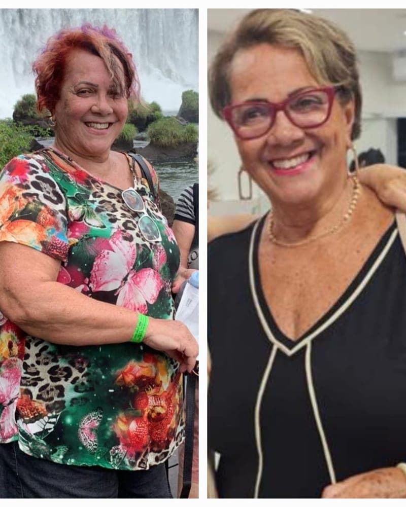 Transformação de Paciente da Alyne, 50+, paciente da Alyne Viana