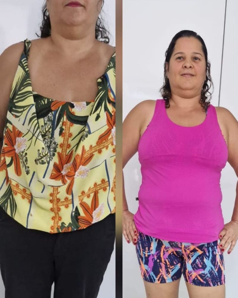 Transformação de Paciente da Alyne, 40+, paciente da Alyne Viana