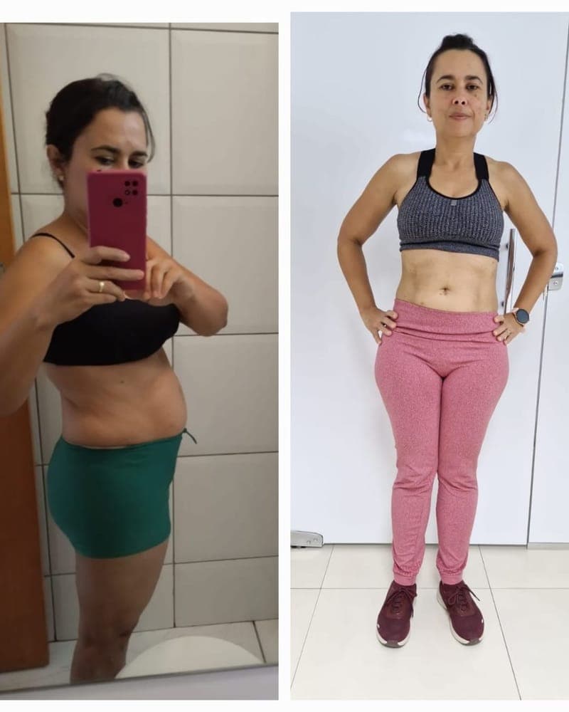 Transformação de Selma, 58 anos, paciente da Alyne Viana